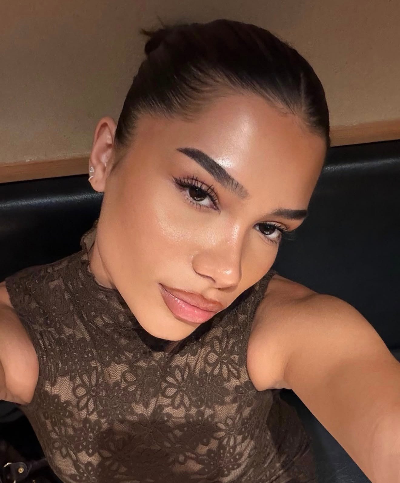 Revision rhinoplasty at Profiles Beverly Hills