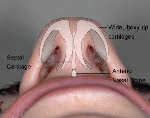 Anatomy of a wide tip