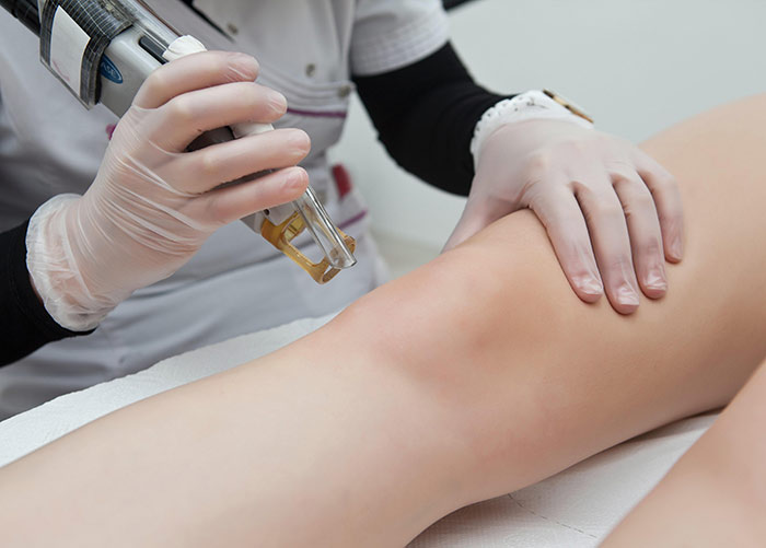 What You Need To Know About Laser Hair Removal