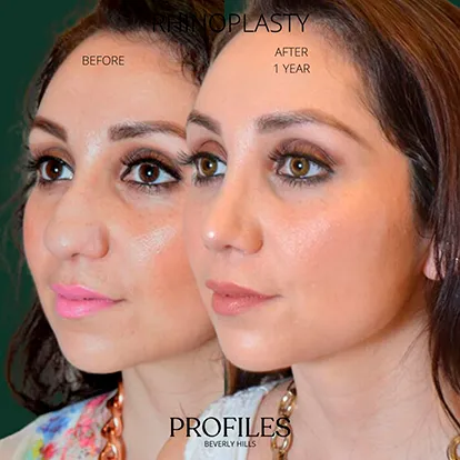 BeforeAfter-04
