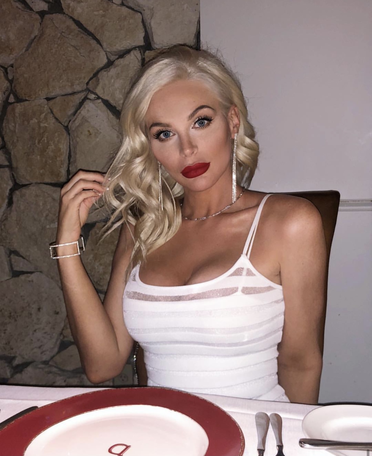 Facelift - Beverlyhillsprofiles - female model