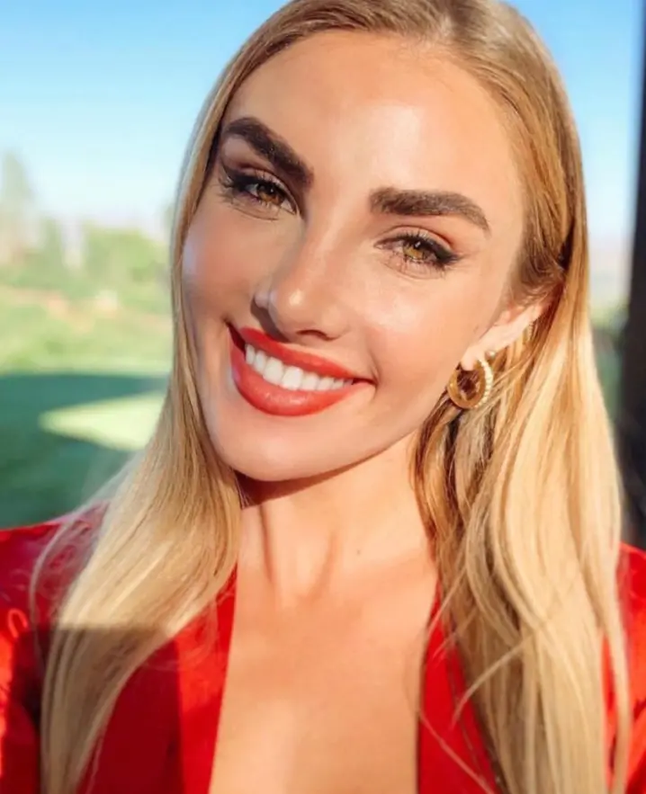 Treatment of Broken, Crooked Noses (smiling female model)